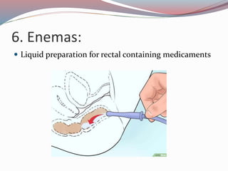 6. Enemas:
 Liquid preparation for rectal containing medicaments
 