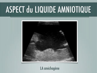 LA anéchogène
ASPECT du LIQUIDE AMNIOTIQUE
 