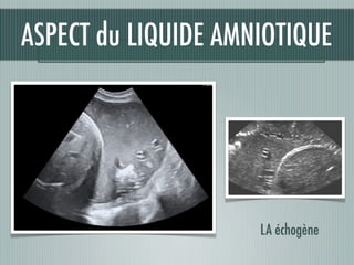 LA échogène
ASPECT du LIQUIDE AMNIOTIQUE
 