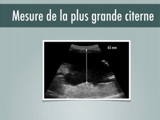 Mesure de la plus grande citerne
65 mm
 