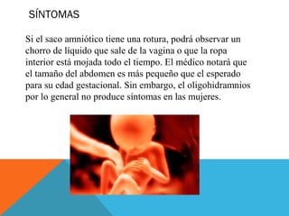 SÍNTOMAS  
Si el saco amniótico tiene una rotura, podrá observar un
chorro de líquido que sale de la vagina o que la ropa
interior está mojada todo el tiempo. El médico notará que
el tamaño del abdomen es más pequeño que el esperado
para su edad gestacional. Sin embargo, el oligohidramnios
por lo general no produce síntomas en las mujeres.
 