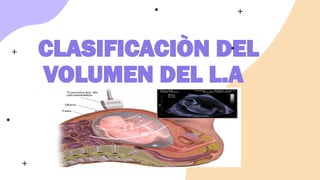 CLASIFICACIÒN DEL
VOLUMEN DEL L.A
 