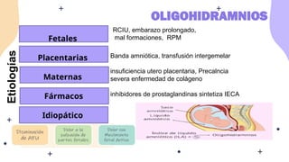 Etiologías
RCIU, embarazo prolongado,
mal formaciones, RPM
Banda amniótica, transfusión intergemelar
insuficiencia utero placentaria, Precalncia
severa enfermedad de colágeno
inhibidores de prostaglandinas sintetiza IECA
OLIGOHIDRAMNIOS
Fetales
Placentarias
Maternas
Fármacos
Idiopático
 