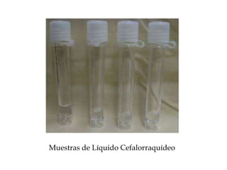 Muestras de Líquido Cefalorraquídeo
 