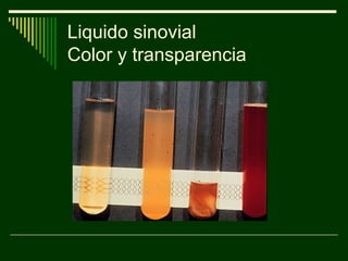 Liquido sinovial
Color y transparencia
 