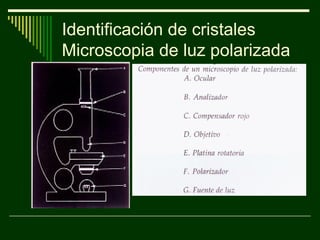 Identificación de cristales
Microscopia de luz polarizada
 