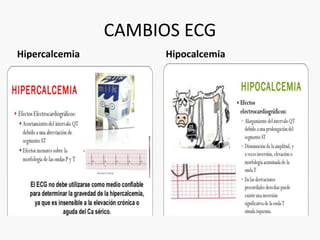 CAMBIOS ECG 
Hipercalcemia Hipocalcemia 
 