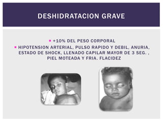 DESHIDRATACION GRAVE
 +10% DEL PESO CORPORAL
 HIPOTENSION ARTERIAL, PULSO RAPIDO Y DEBIL, ANURIA,
ESTADO DE SHOCK, LLENADO CAPILAR MAYOR DE 3 SEG. ,
PIEL MOTEADA Y FRIA. FLACIDEZ
 