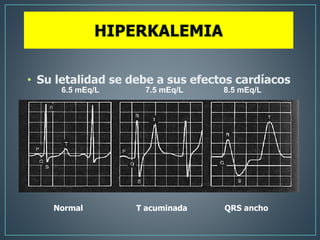 Liquidos y electrolitos | PPTX