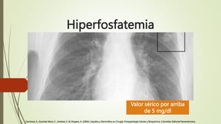 Hiperfosfatemia
Valor sérico por arriba
de 5 mg/dl
Carrizosa, E., Guzmán Mora, F., Jiménez, E. & Vergara, A. (2004). Líqui...