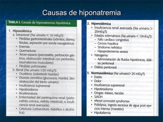 Causas de hiponatremiaCausas de hiponatremia
 
