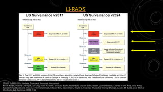 Comprehensive LI-RADS CT Protocol and HCC Characterization for Liver ...