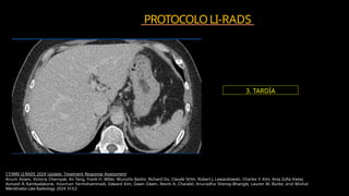 Comprehensive LI-RADS CT Protocol and HCC Characterization for Liver ...