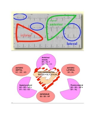 Lire un ecg amis med.com