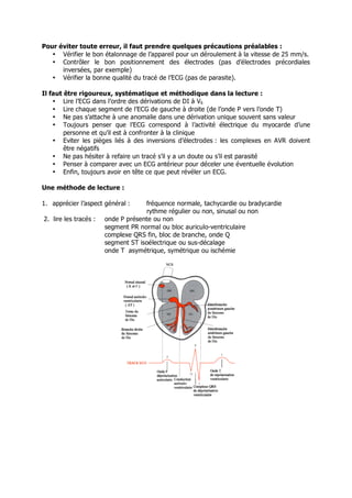 Pour éviter toute erreur, il faut prendre quelques précautions préalables :
   • Vérifier le bon étalonnage de l’appareil pour un déroulement à la vitesse de 25 mm/s.
   • Contrôler le bon positionnement des électrodes (pas d’électrodes précordiales
      inversées, par exemple)
   • Vérifier la bonne qualité du tracé de l’ECG (pas de parasite).

Il faut être rigoureux, systématique et méthodique dans la lecture :
    • Lire l’ECG dans l’ordre des dérivations de DI à V6
    • Lire chaque segment de l’ECG de gauche à droite (de l’onde P vers l’onde T)
    • Ne pas s’attache à une anomalie dans une dérivation unique souvent sans valeur
    • Toujours penser que l’ECG correspond à l’activité électrique du myocarde d’une
        personne et qu’il est à confronter à la clinique
    • Eviter les pièges liés à des inversions d’électrodes : les complexes en AVR doivent
        être négatifs
    • Ne pas hésiter à refaire un tracé s’il y a un doute ou s’il est parasité
    • Penser à comparer avec un ECG antérieur pour déceler une éventuelle évolution
    • Enfin, toujours avoir en tête ce que peut révéler un ECG.

Une méthode de lecture :

1. apprécier l’aspect général :     fréquence normale, tachycardie ou bradycardie
                                    rythme régulier ou non, sinusal ou non
2. lire les tracés :   onde P présente ou non
                       segment PR normal ou bloc auriculo-ventriculaire
                       complexe QRS fin, bloc de branche, onde Q
                       segment ST isoélectrique ou sus-décalage
                       onde T asymétrique, symétrique ou ischémie
 