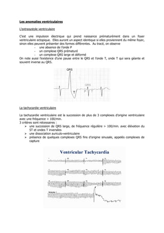 Les anomalies ventriculaires

L’extrasystole ventriculaire

C’est une impulsion électrique qui prend naissance prématurément dans un foyer
ventriculaire ectopique. Elles auront un aspect identique si elles proviennent du même foyer,
sinon elles peuvent présenter des formes différentes. Au tracé, on observe
            - une absence de l’onde P
            - un complexe QRS prématuré
            - un complexe QRS large et déformé
On note aussi l’existence d’une pause entre le QRS et l’onde T, onde T qui sera géante et
souvent inverse au QRS.




La tachycardie ventriculaire

La tachycardie ventriculaire est la succession de plus de 3 complexes d’origine ventriculaire
avec une fréquence > 100/min.
3 critères sont nécessaires :
     une succession de QRS large, de fréquence régulière > 100/min. avec élévation du
        ST et ondes T inversées
     une dissociation auriculo-ventriculaire
     présence de quelques complexes QRS fins d’origine sinusale, appelés complexes de
        capture
 