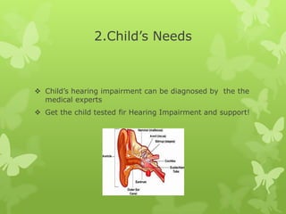 2.Child’s Needs



 Child’s hearing impairment can be diagnosed by the the
  medical experts
 Get the child tested fir Hearing Impairment and support!
 