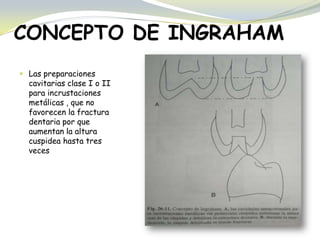 CONCEPTO DE INGRAHAM
 Las preparaciones
cavitarias clase I o II
para incrustaciones
metálicas , que no
favorecen la fractura
dentaria por que
aumentan la altura
cuspidea hasta tres
veces
 