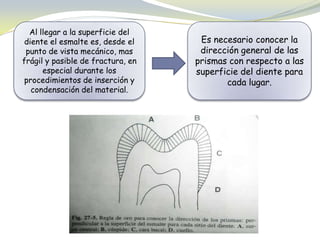 Al llegar a la superficie del
diente el esmalte es, desde el
punto de vista mecánico, mas
frágil y pasible de fractura, en
especial durante los
procedimientos de inserción y
condensación del material.
Es necesario conocer la
dirección general de las
prismas con respecto a las
superficie del diente para
cada lugar.
 