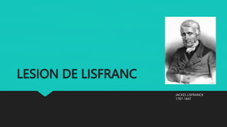 LESION DE LISFRANC
JACKES LISFRANCK
1787-1847
 