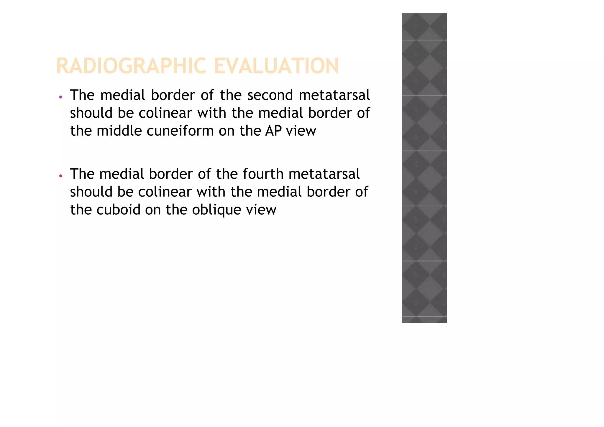 RADIOGRAPHIC EVALUATION
• The medial border of the second metatarsal
should be colinear with the medial border of
the middle cuneiform on the AP view
• The medial border of the fourth metatarsal
should be colinear with the medial border of
the cuboid on the oblique view
 