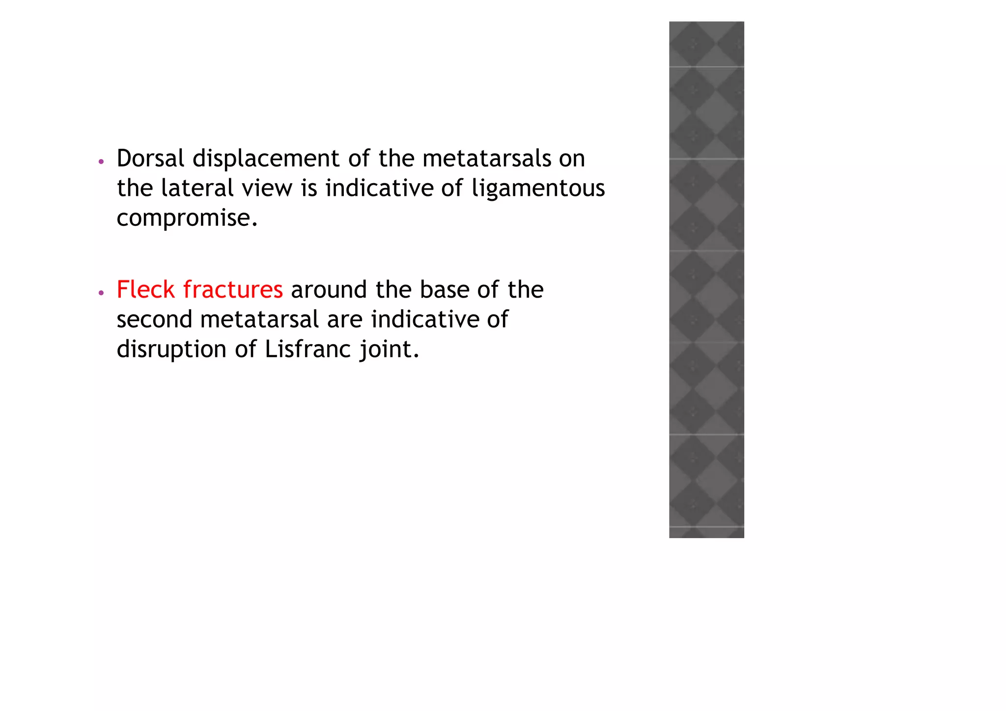 • Dorsal displacement of the metatarsals on
the lateral view is indicative of ligamentous
compromise.
• Fleck fractures around the base of the
second metatarsal are indicative of
disruption of Lisfranc joint.
 
