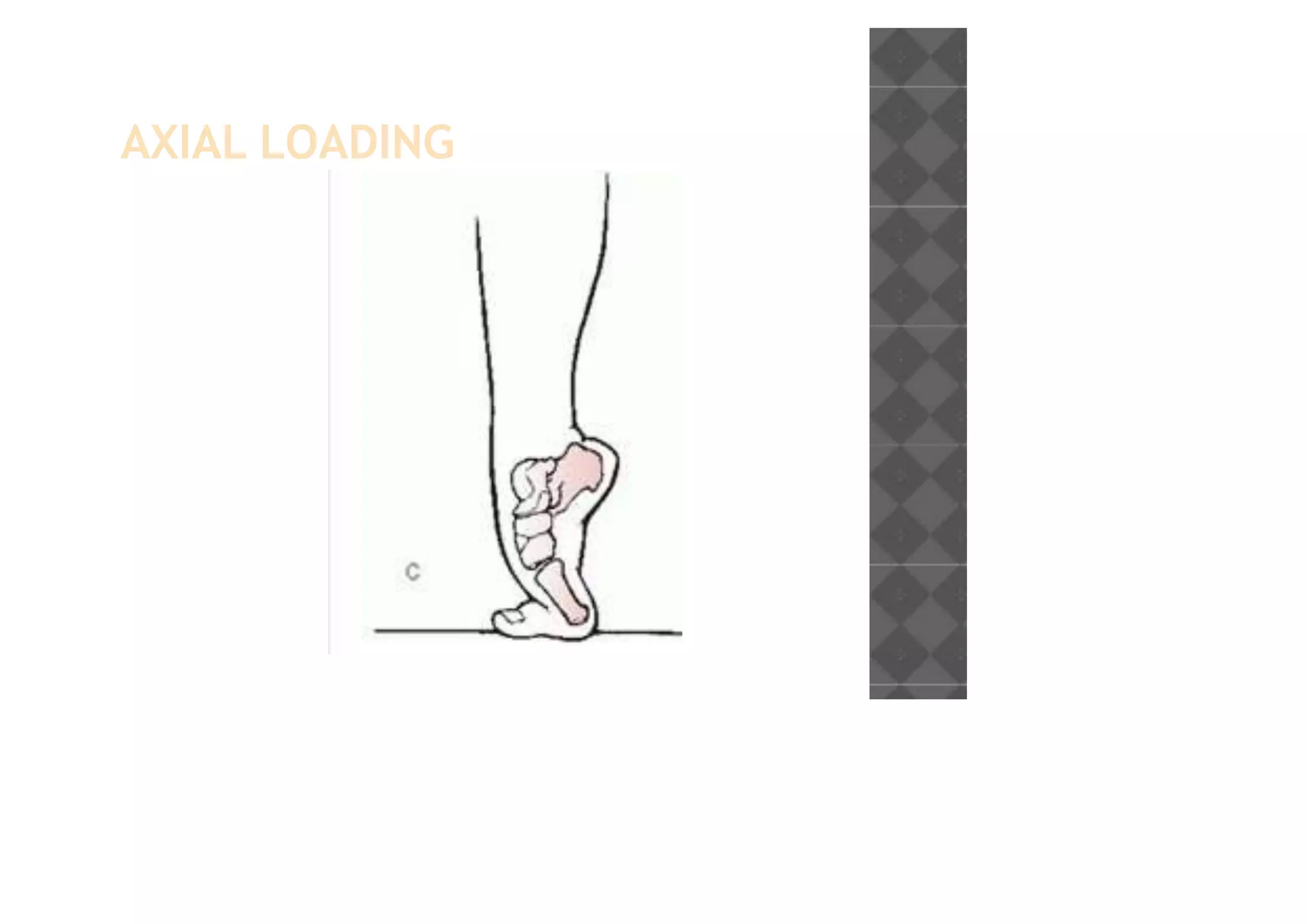 AXIAL LOADING
 