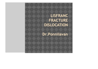 LISFRANC
FRACTURE
DISLOCATION
Dr.Ponnilavan
 