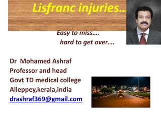 Lisfranc injuries…
Easy to miss….
hard to get over….
Dr Mohamed Ashraf
Professor and head
Govt TD medical college
Alleppey,kerala,india
drashraf369@gmail.com
 