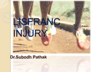 LISFRANC
INJURY
Dr.Subodh Pathak
 