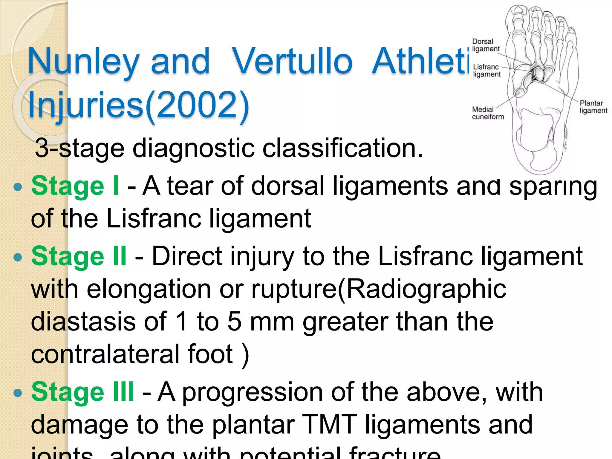 Lisfranc injury- | PPTX