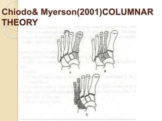 Lisfranc injury- | PPTX