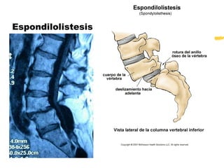 Listesis Lisis y listesis | PPT
