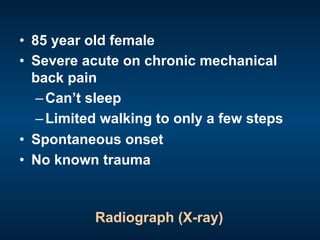 •  85 year old female
•  Severe acute on chronic mechanical
back pain
– Can’t sleep
– Limited walking to only a few steps
•  Spontaneous onset
•  No known trauma
Radiograph (X-ray)
 