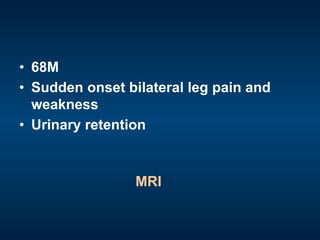 •  68M
•  Sudden onset bilateral leg pain and
weakness
•  Urinary retention
MRI
 