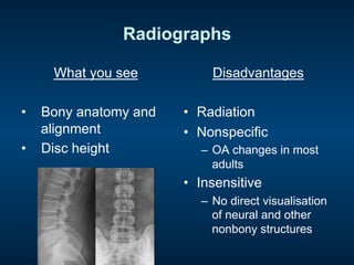 Radiographs
What you see
•  Bony anatomy and
alignment
•  Disc height
Disadvantages
•  Radiation
•  Nonspecific
–  OA changes in most
adults
•  Insensitive
–  No direct visualisation
of neural and other
nonbony structures
 