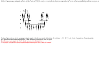 5. (Ufc) A figura a seguir, adaptada da Folha de São Paulo de 17/03/96, mostra a transmissão do albinismo, de geração, na Família de Raimundo e Eleílde da Silva, moradores da
Analise a figura onde se admite que a pigmentação da pele é devida a um par de alelos (A,a). Os indivíduos I - 1, II - 6, V - 2, V - 3 e V - 5 são albinos. Responda, então:
a) O albinismo se deve a alelo dominante ou a alelo recessivo? Explique com base na figura.
5. a) Recessivo pois os pais IV - 1 e IV - 2 são normais e têm filhos albinos.
c) 1/4 porque Paulo e Joana serão obrigatoriamente heterozigotos para o gene em questão.
 