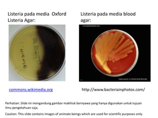 Listeria pada media blood
agar:
http://www.bacteriainphotos.com/
commons.wikimedia.org
Listeria pada media Oxford
Listeria Agar:
Perhatian: Slide ini mengandung gambar makhluk bernyawa yang hanya digunakan untuk tujuan
ilmu pengetahuan saja.
Caution: This slide contains images of animate beings which are used for scientific purposes only.
 