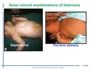 Occurrence of Listeria monocytogenes in traditionally processed fish in informal markets in Accra, Ghana