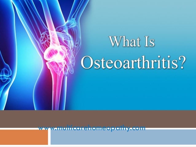 List of 6 best homeopathic medicines for osteoarthritis List of 6 best homeopathic medicines for osteoarthritis