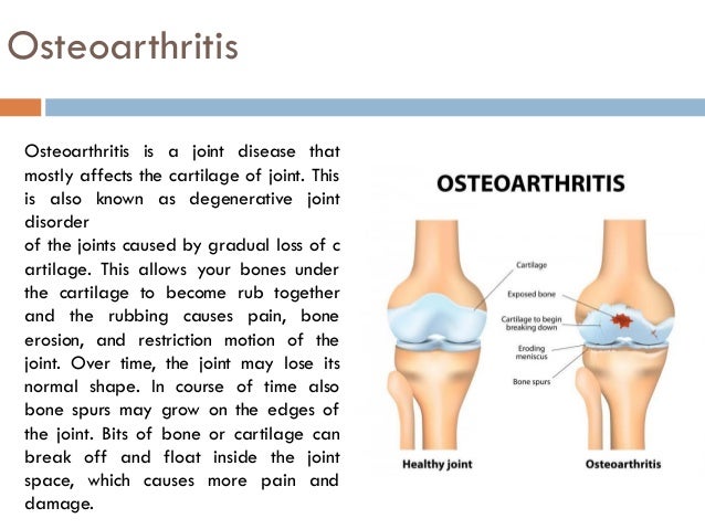 List of 6 best homeopathic medicines for osteoarthritis List of 6 best homeopathic medicines for osteoarthritis