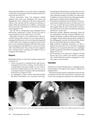 Literature review a surgeon's view of recurrent hiatal hernia | PDF