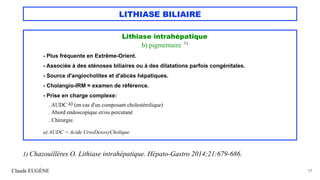 LITHIASE BILIAIRE
Lithiase intrahépatique
b) pigmentaire 1)
- Plus fréquente en Extrême-Orient.
- Associée à des sténoses biliaires ou à des dilatations parfois congénitales.
- Source d'angiocholites et d'abcès hépatiques.
- Cholangio-IRM = examen de référence.
- Prise en charge complexe:
. AUDC a) (en cas d'un composant cholestérolique)
. Abord endoscopique et/ou percutané
. Chirurgie.
a) AUDC = Acide UrsoDesoxyCholique
Claude EUGÈNE 17
1) Chazouillères O. Lithiase intrahépatique. Hépato-Gastro 2014;21:679-686.
 