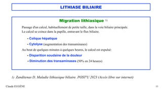 LITHIASE BILIAIRE
Migration lithiasique 1)
Passage d'un calcul, habituellement de petite taille, dans la voie biliaire principale.
Le calcul se coince dans la papille, entravant le flux biliaire.
- Colique hépatique
- Cytolyse (augmentation des transaminases)
Au bout de quelques minutes à quelques heures, le calcul est expulsé:
- Disparition soudaine de la douleur
- Diminution des transaminases (50% en 24 heures)
Claude EUGÈNE 23
1) Zanditenas D. Maladie lithiasique biliaire. POST'U 2023 (Accès libre sur internet)
 