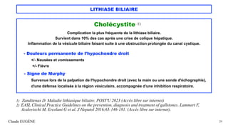 LITHIASE BILIAIRE
Cholécystite 1)
Complication la plus fréquente de la lithiase biliaire.
Survient dans 10% des cas après une crise de colique hépatique.
Inflammation de la vésicule biliaire faisant suite à une obstruction prolongée du canal cystique.
- Douleurs permanente de l'hypochondre droit
+/- Nausées et vomissements
+/- Fièvre
- Signe de Murphy
Survenue lors de la palpation de l'hypochondre droit (avec la main ou une sonde d'échographie),
d'une défense localisée à la région vésiculaire, accompagnée d'une inhibition respiratoire.
Claude EUGÈNE 24
1) Zanditenas D. Maladie lithiasique biliaire. POST'U 2023 (Accès libre sur internet)
2) EASL Clinical Practice Guidelines on the prevention, diagnosis and treatment of gallstones. Lammert F,
Acalovischi M, Ercolani G et al. J Hepatol 2016;65:146-181. (Accès libre sur internet).
 