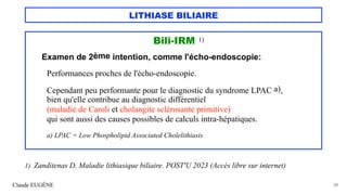 LITHIASE BILIAIRE
Bili-IRM 1)
Examen de 2ème intention, comme l'écho-endoscopie:
Performances proches de l'écho-endoscopie.
Cependant peu performante pour le diagnostic du syndrome LPAC a),
bien qu'elle contribue au diagnostic différentiel
(maladie de Caroli et cholangite sclérosante primitive)
qui sont aussi des causes possibles de calculs intra-hépatiques.
a) LPAC = Low Phospholipid Associated Cholelithiasis
Claude EUGÈNE 31
1) Zanditenas D. Maladie lithiasique biliaire. POST'U 2023 (Accès libre sur internet)
 