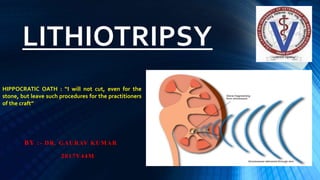 LITHIOTRIPSY
BY :- DR. GAURAV KUMAR
2017V44M
HIPPOCRATIC OATH : “I will not cut, even for the
stone, but leave such procedures for the practitioners
of the craft”
 