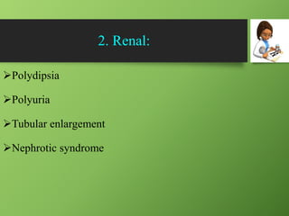 2. Renal:
Polydipsia
Polyuria
Tubular enlargement
Nephrotic syndrome
 