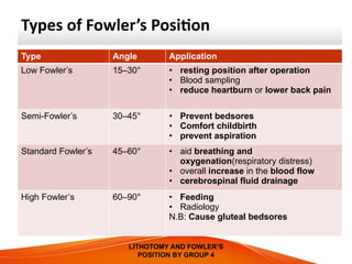 Comprehensive Overview of Lithotomy and Fowler’s Surgical Positions ...