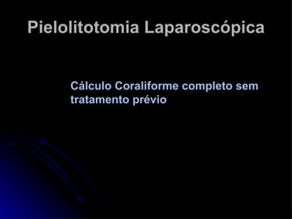 Pielolitotomia Laparoscópica Cálculo Coraliforme completo sem tratamento prévio 